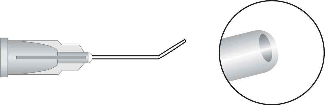 Anterior Chamber Cannula (Rycroft) (Air Injection & Irrigating Cannula)